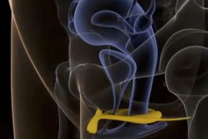 internal clitoris - betty dodson